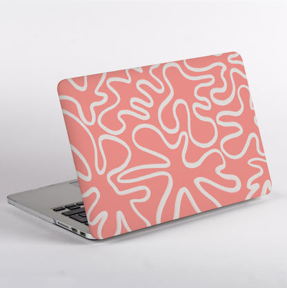 Sid view of MacBook with a pink and white abstract pattern case
