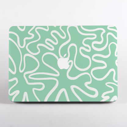 MacBook with mint green and white line patterned case 