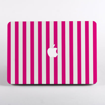 MacBook with pink and white striped case