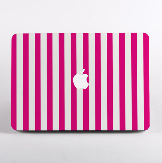 MacBook with pink and white striped case